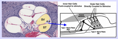 Cross-section of the cochlea (left), with illustration of IHCs and OHCs (right).